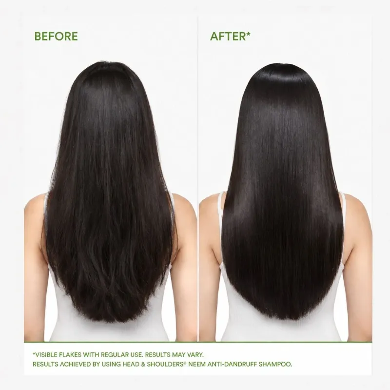 Head & Shoulders Cool Menthol Anticaspa
