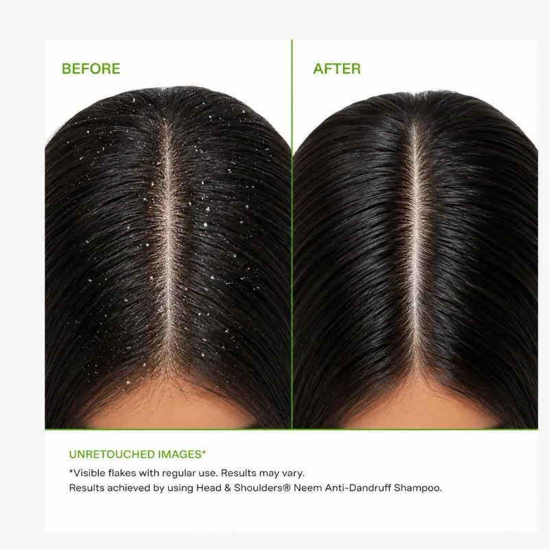 Head & Shoulders Neem Anticaspa
