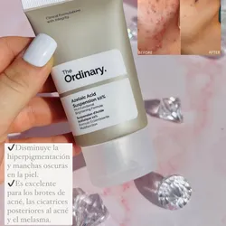 The Ordinary Vitamina C