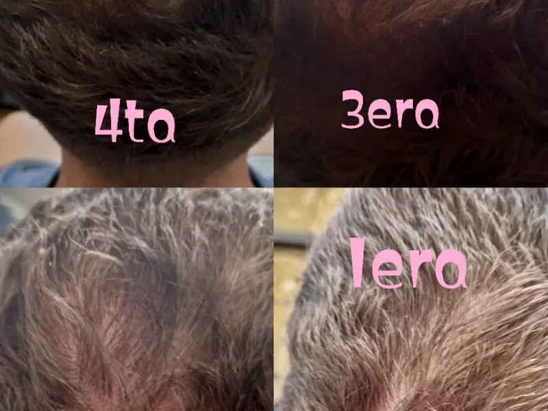 Tratamientos capilares 