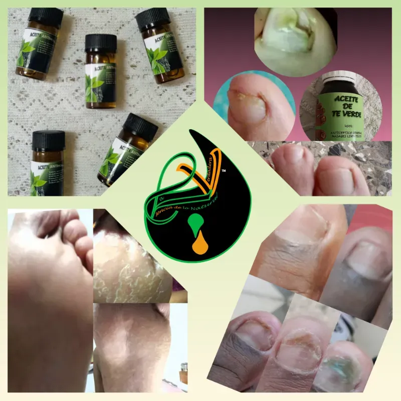 Aceites 💯% naturales