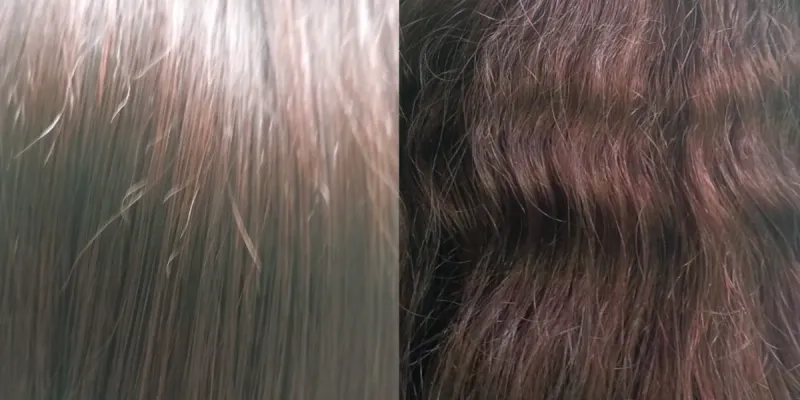 Keratina orgánica con láser fotónico 