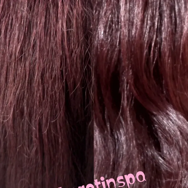 Keratina orgánica con láser fotónico 