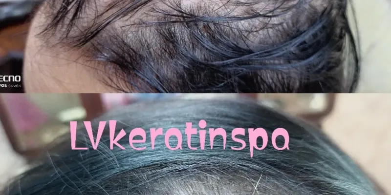 Tratamiento de regeneración capilar 