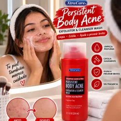 Gel de baño para pieles acneicas