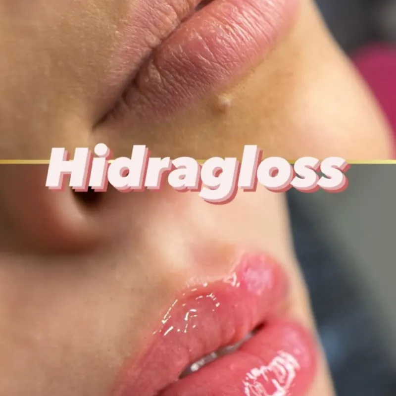 Hidratación de Labios 