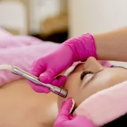 Microdermoabrasión