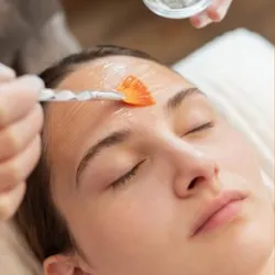 Peeling Químico 