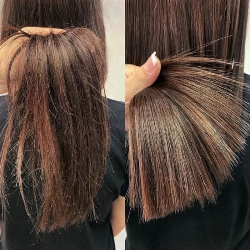 Corte Terapéutico
