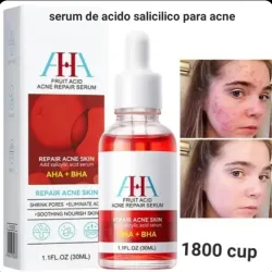Serum de acido salicilico