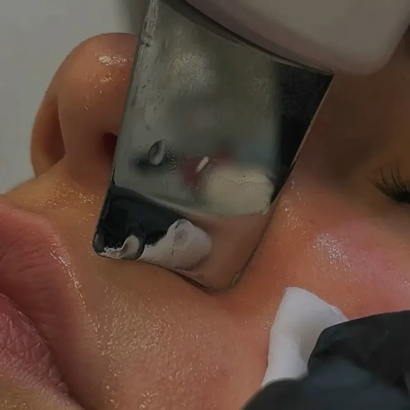 Limpieza facial básica