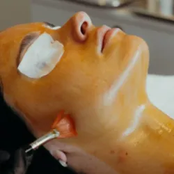 Peeling químico