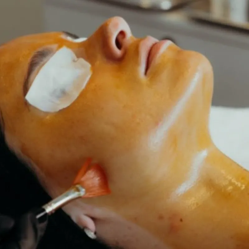 Peeling químico