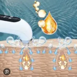 HIDRADERMOABRACION SEGÚN BIOTIPO CUTÁNEO(no lleva extracción)