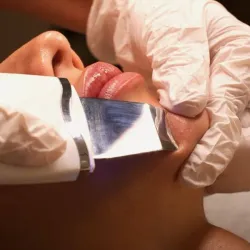 Limpieza facial profunda 