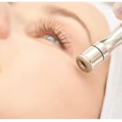 MICRODERMOABRASIÓN CON PUNTA DE DIAMANTE