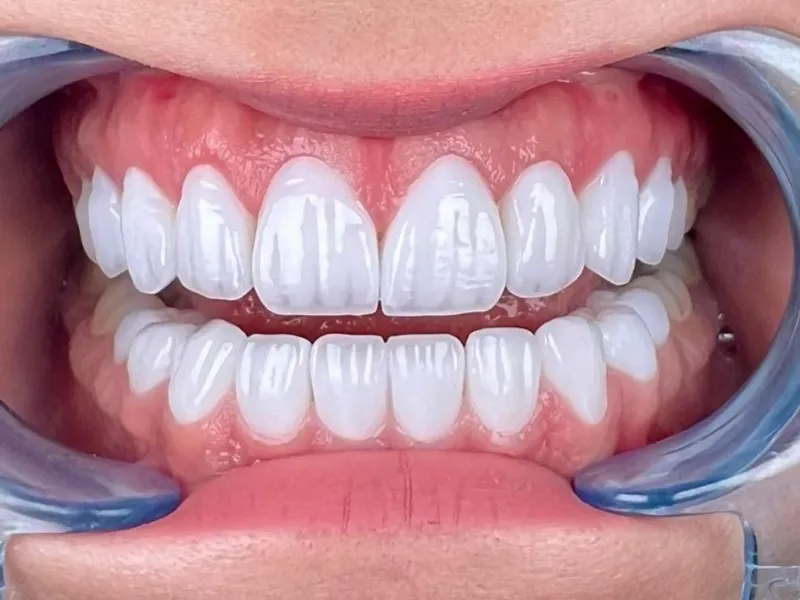 Bucodental