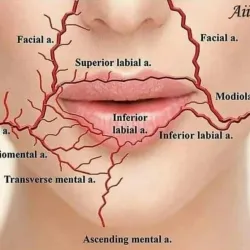 Curso de ácido hialurónico y armonización facial