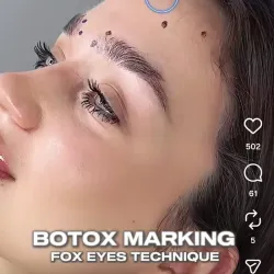 Servicio de Baby Botox facial