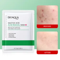 Mascarilla de Ácido Salicílico
