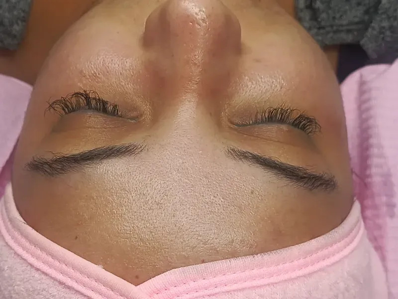 Facial