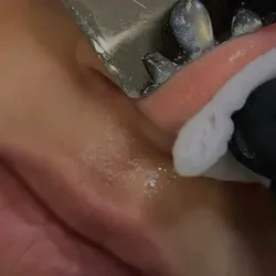 Limpieza Facial Profunda