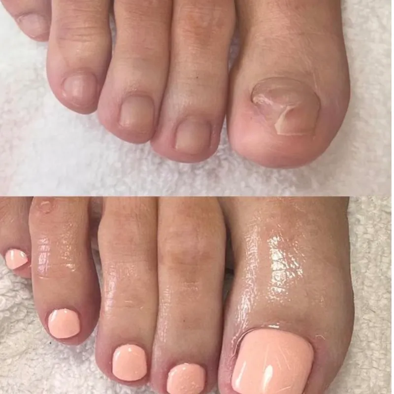 Pedicura + Gel de contruccion