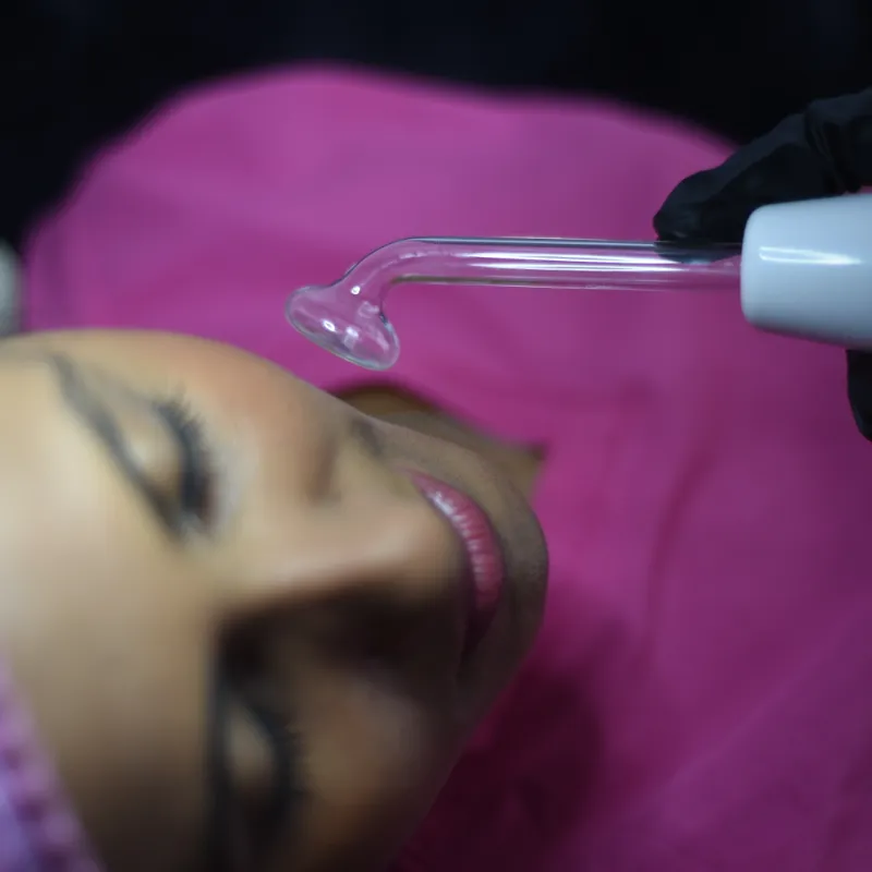 Limpieza facial profunda 