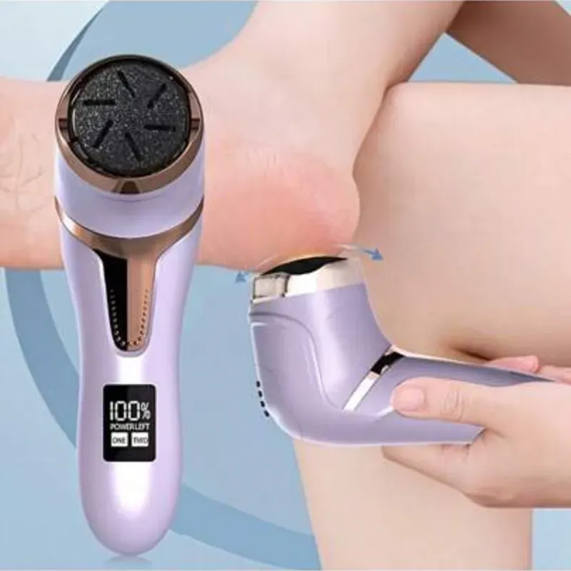 Removedor  de callos