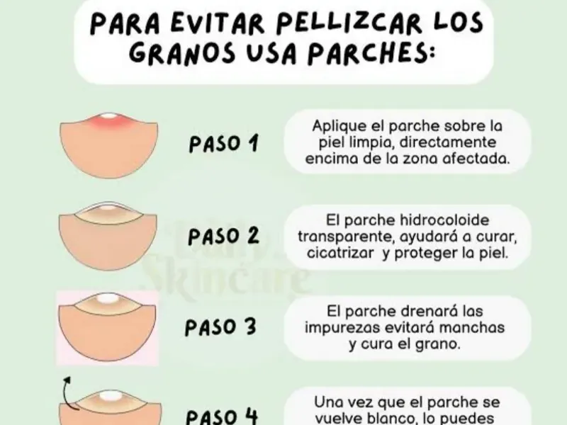 Parches Para El Acné 