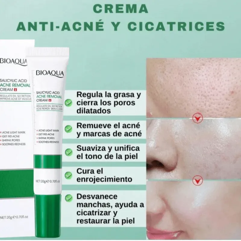Crema De Ácido Salicilico