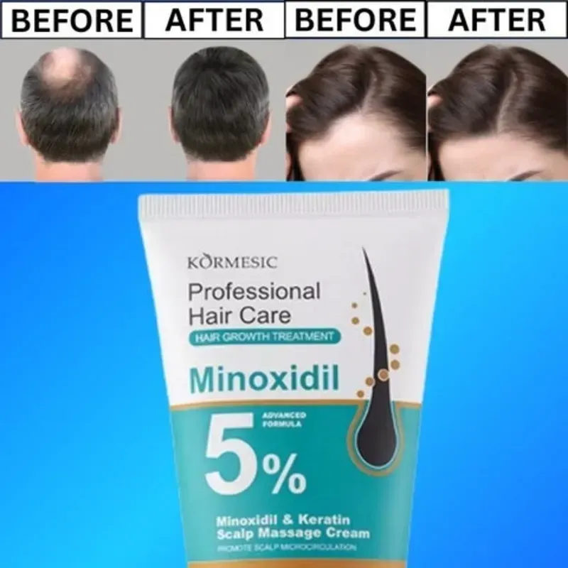 Crema de Minoxidil