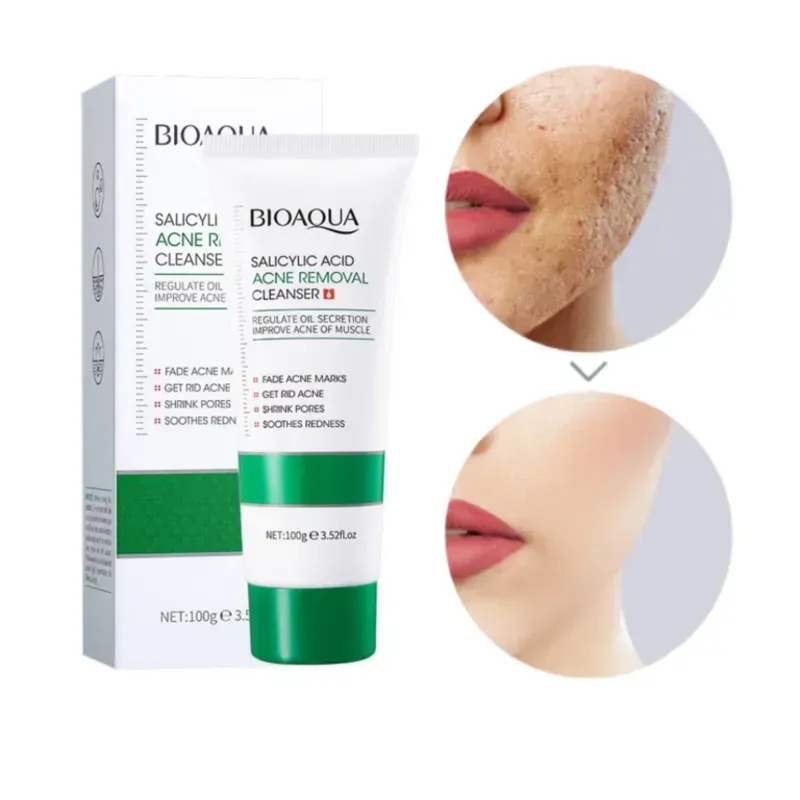 Limpiador Facial de Ácido Salicílico