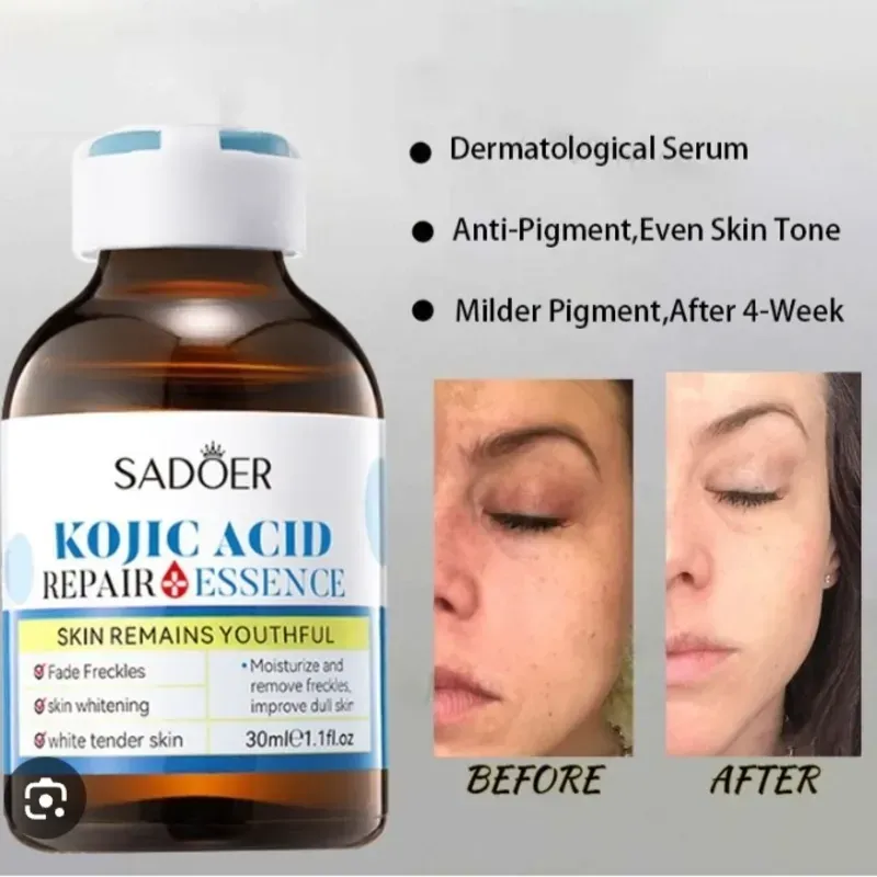 Sérum de Ácido Kójico