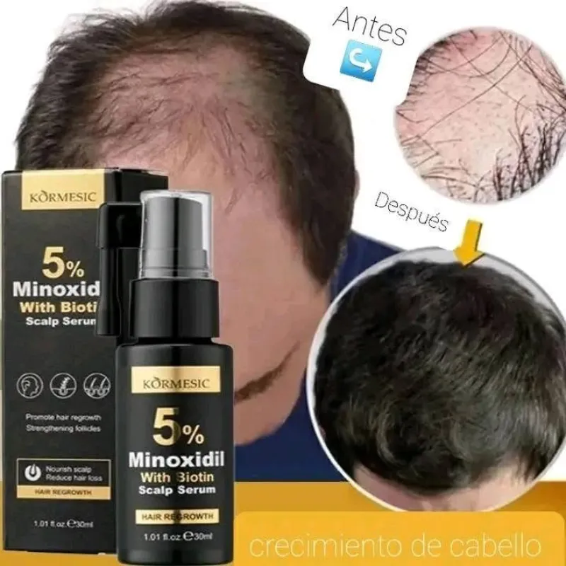Sérum de Minoxidil y Biotina