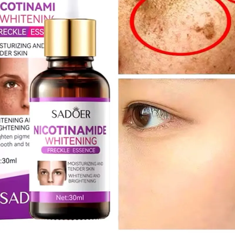 Serum de Niacinamida