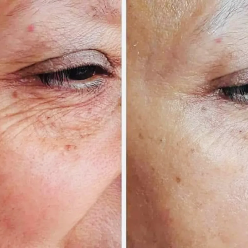 Facial Antienvejecimiento