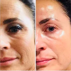 Facial Antienvejecimiento
