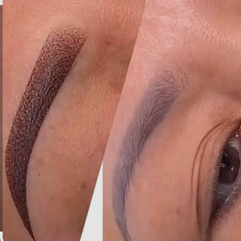 La neutralización de Cejas