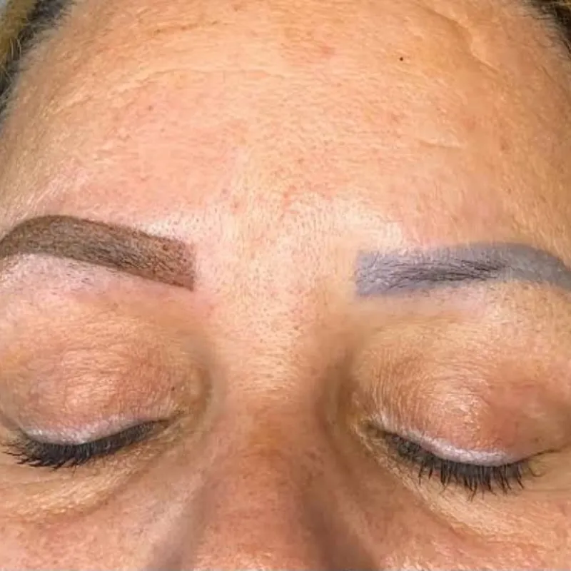 La neutralización de Cejas