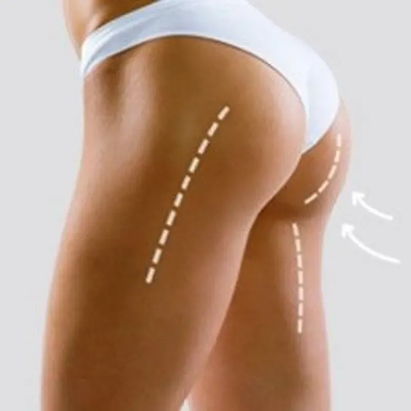 Levantamiento de glúteos con masaje, drenaje linfático y maderoterapia