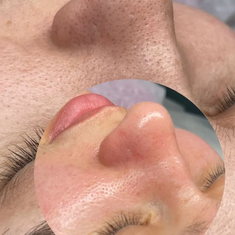 Limpieza Facial 