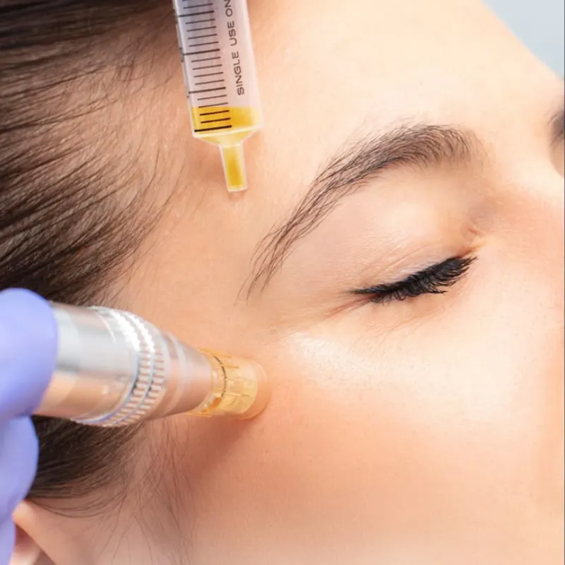Microneedling Facial con Dermapen