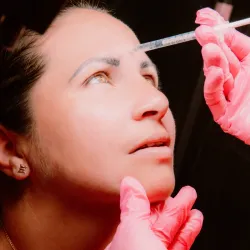 Aplicación de Toxina Botulínica