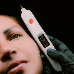 Fibroblast