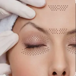 Plasmapen zona mínima 