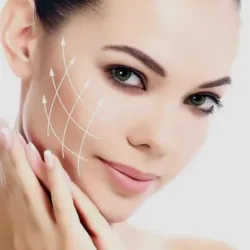 Lifting del macizo facial medio