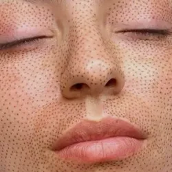 Plasmapen zona máxima