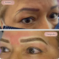 Corrección de pigmentación de cejas