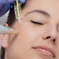 Dermapen & PRP (Plasma Rico en Plaquetas)